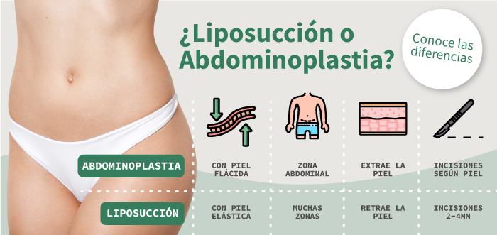 Cuáles son los beneficios de una Abdominoplastia? - Clínica Saint Paul