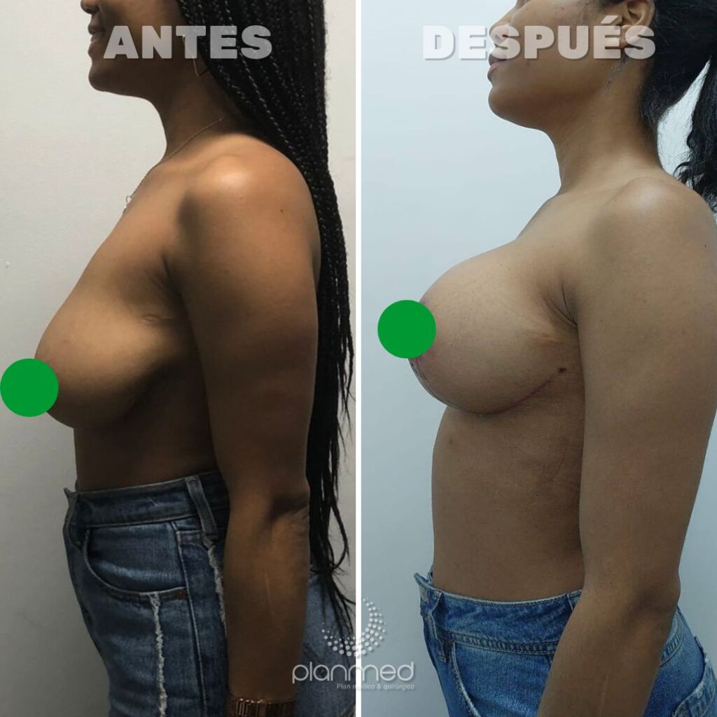 CREDITO, CUOTAS, AHORRO, FINANCIACION, CIRUGIA PLASTICA, MEDELLIN, CALI, COLOMBIA, PRESTAMO, BANCO, COOPERATIVA, MAMOPLASTIA, CIRUGIA MAMARIA