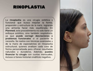 FINANCIACION CIRUGIA PLASTICA LIPOABDOMINOPLASTIA, ABDOMINOPLASTIA, LIPOTRANSFERENCIAFINANCIERA, COOPERATIVA, ENTIDAD AHORRO, CREDITO, APROBADO