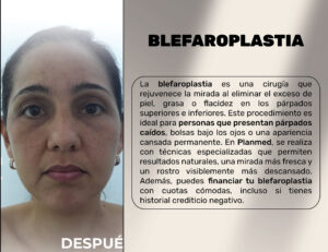 FINANCIACION CIRUGIA PLASTICA LIPOABDOMINOPLASTIA, ABDOMINOPLASTIA, LIPOTRANSFERENCIAFINANCIERA, COOPERATIVA, ENTIDAD AHORRO, CREDITO, APROBADO