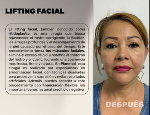 FINANCIACION CIRUGIA PLASTICA LIPOABDOMINOPLASTIA, ABDOMINOPLASTIA, LIPOTRANSFERENCIAFINANCIERA, COOPERATIVA, ENTIDAD AHORRO, CREDITO, APROBADO