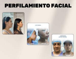 FINANCIACION CIRUGIA PLASTICA LIPOABDOMINOPLASTIA, ABDOMINOPLASTIA, LIPOTRANSFERENCIAFINANCIERA, COOPERATIVA, ENTIDAD AHORRO, CREDITO, APROBADO