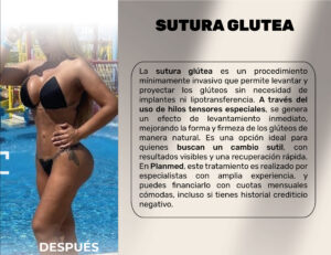 FINANCIACION CIRUGIA PLASTICA LIPOABDOMINOPLASTIA, ABDOMINOPLASTIA, LIPOTRANSFERENCIAFINANCIERA, COOPERATIVA, ENTIDAD AHORRO, CREDITO, APROBADO